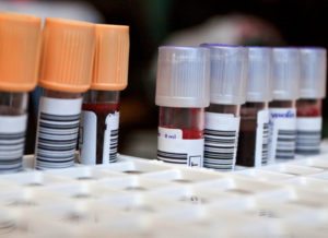 Blood tests for Hashimoto's disease