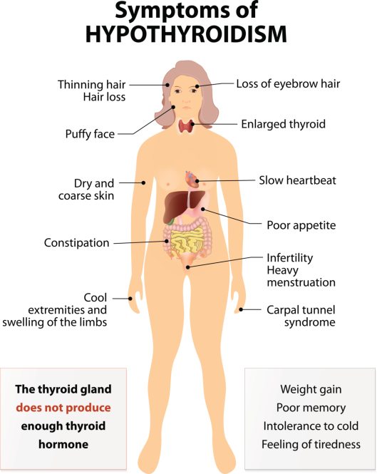 Symptoms hypothyroidism Hypothyroidism symptoms