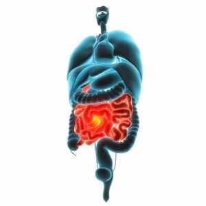 what is leaky gut syndrome