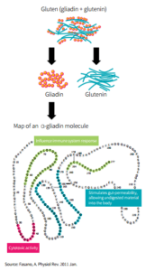 What Is Leaky Gut Syndrome and Is It Even Real? A Sales-Free Look
