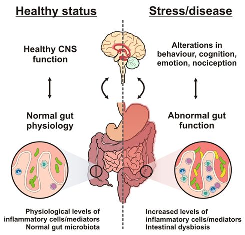 gut brain axis and depression