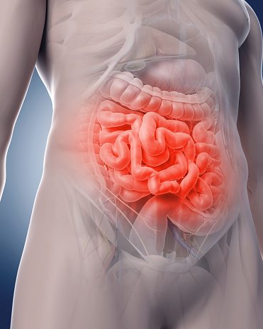 Does Candida Cause Leaky Gut Syndrome