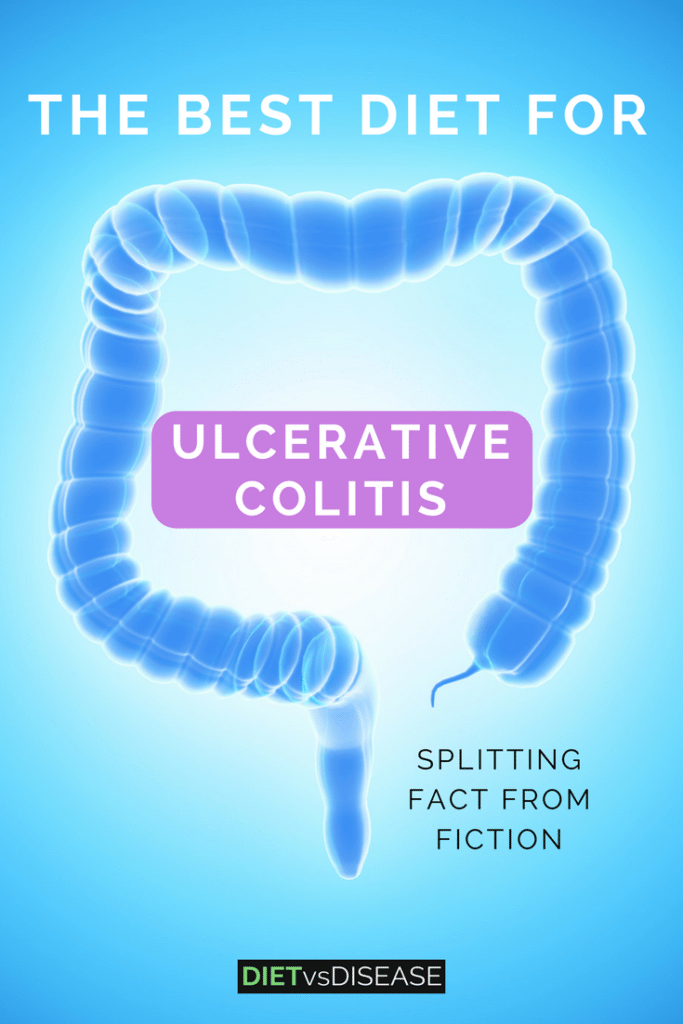 No one diet can cure ulcerative colitis. However, certain diet changes can greatly ease discomfort and symptoms. This article looks at the current research: https://www.dietvsdisease.org/ulcerative-colitis-diet/