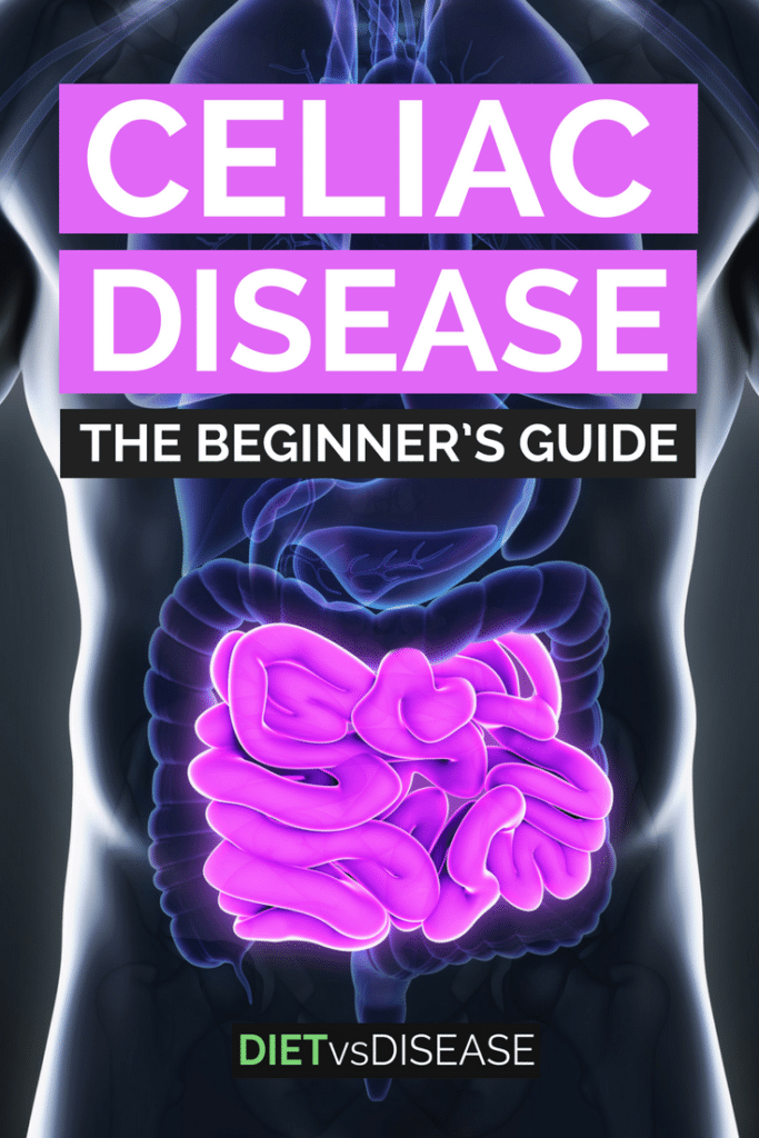 Around 1 in 100 people have celiac disease worldwide. This article takes a detailed look at managing the condition and how to do a gluten-free diet: https://www.dietvsdisease.org/celiac-disease-diet/