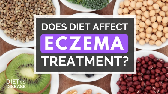 Does Diet Affect Eczema Treatment-