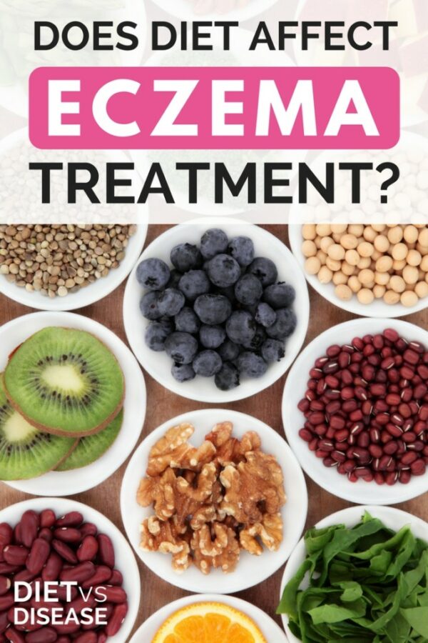 Does Diet Affect Eczema Treatment? Diet vs Disease