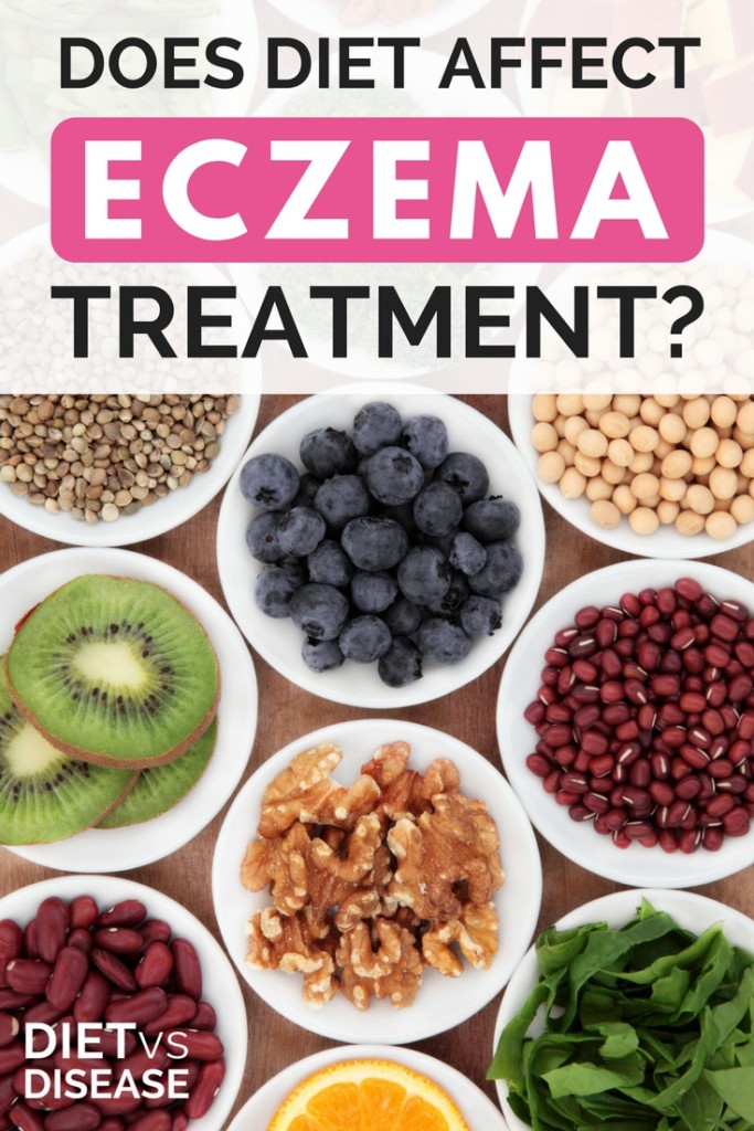 Does Diet Affect Eczema Treatment- (1)