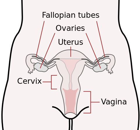 Endometriosis Causes