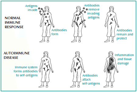 Is Endometriosis an Autoimmune Disease