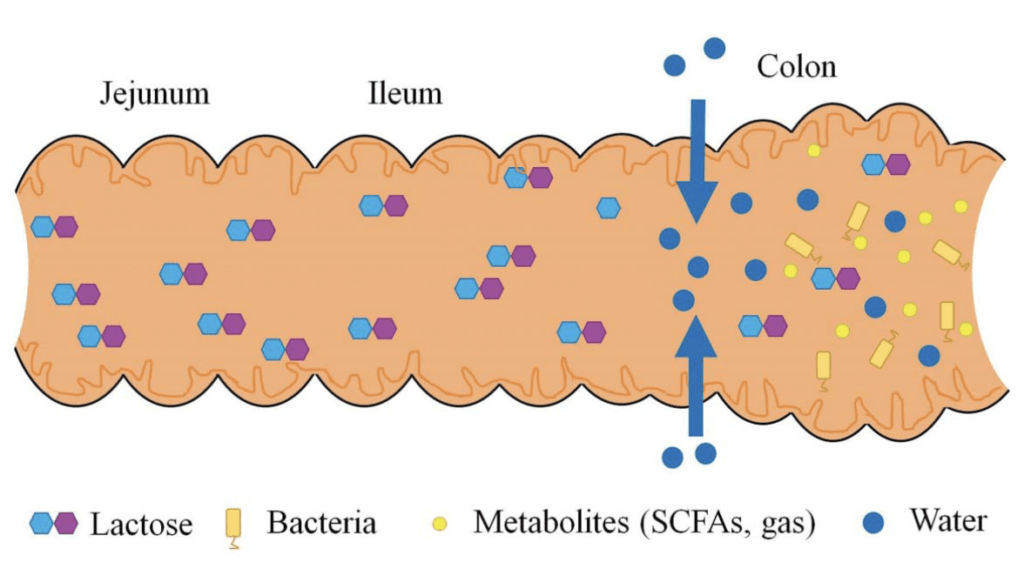 Lactose Malabsorption or Lactose Intolerance?