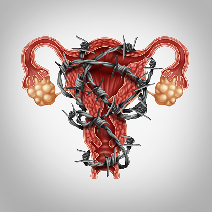 What is Endometriosis