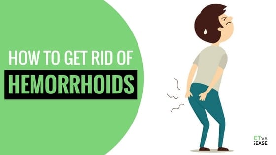 How to Get Rid of Hemorrhoids