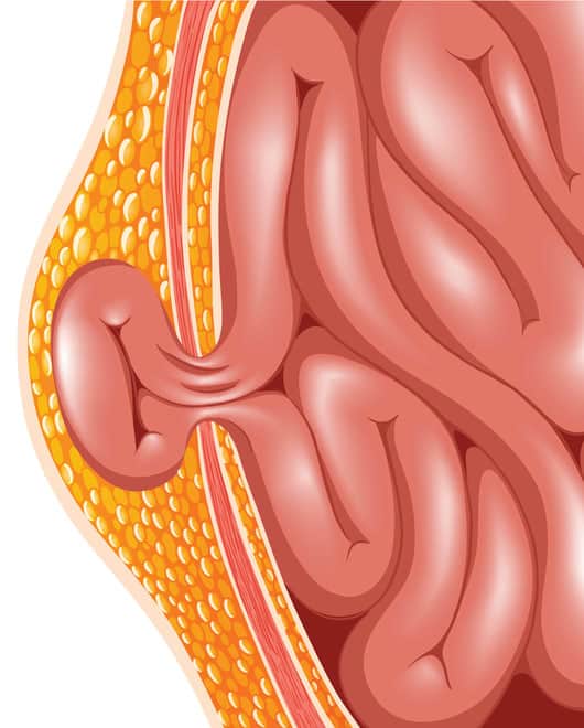 Other Major Causes and Conditions