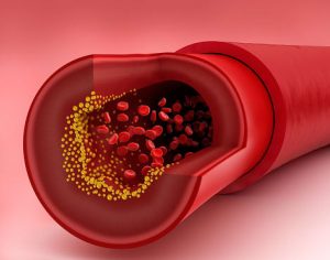 What is HbA1c