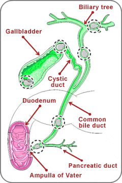 What is a Gallbladder Flush?