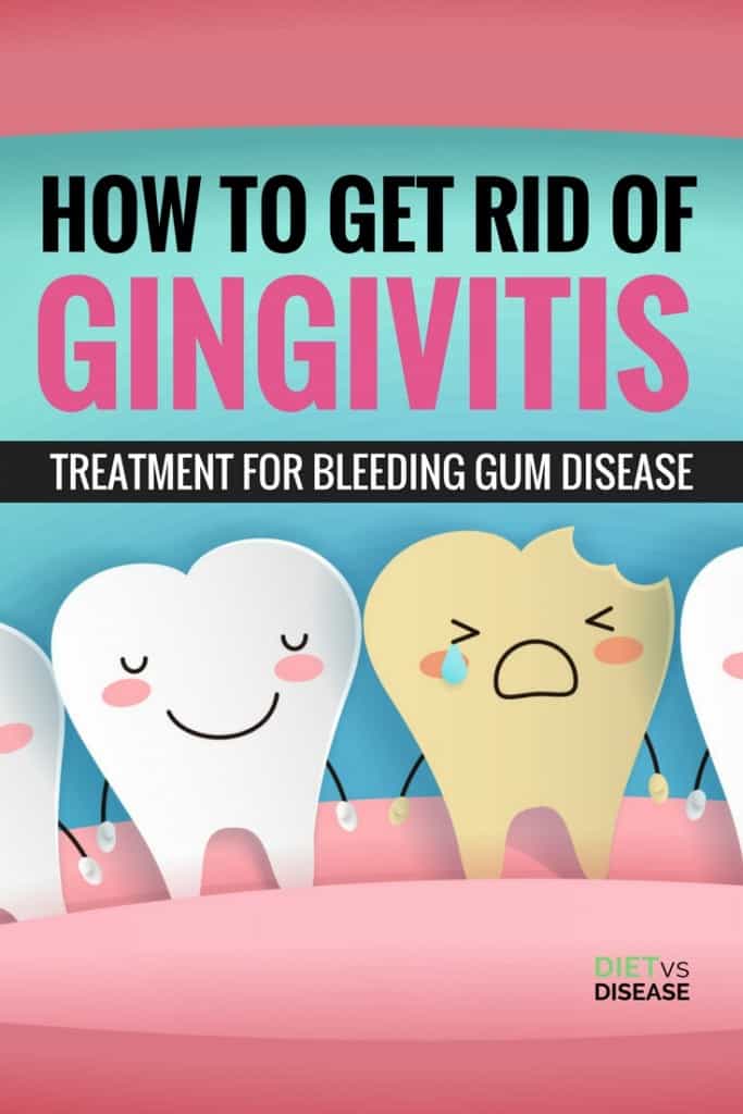 How to Get Rid of Gingivitis_ Treatment for Bleeding Gum Disease