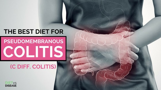 The Best Diet for Pseudomembranous Colitis blog