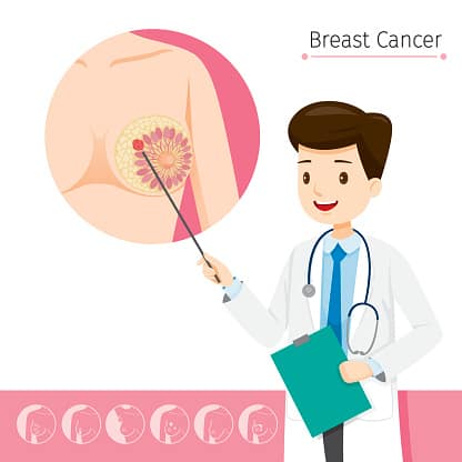 CDB aceite alivia los síntomas de cáncer y puede tener efectos anti-tumorales