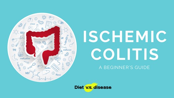 A Beginner’s Guide to Ischemic Colitis