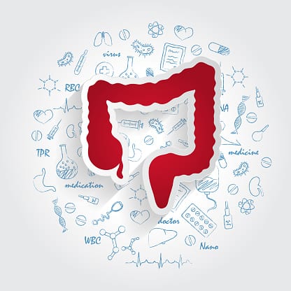 What is Ischemic Colitis?