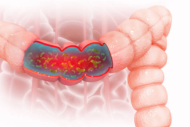 Image of a dietitian holding a stack of papers in hand which are test results. Visual concept of Bacterial infection of the colon, colon cancer. 3d illustration.
