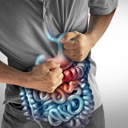 IBS Symptoms and Stomach Pains or stomachache with a painful digestive system ache as an abdominal illness or irritable bowel syndrome and Ulcers representing intestinal inflammation or bloating.